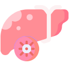 Alcoholic Hepatitis