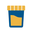 Dark urine