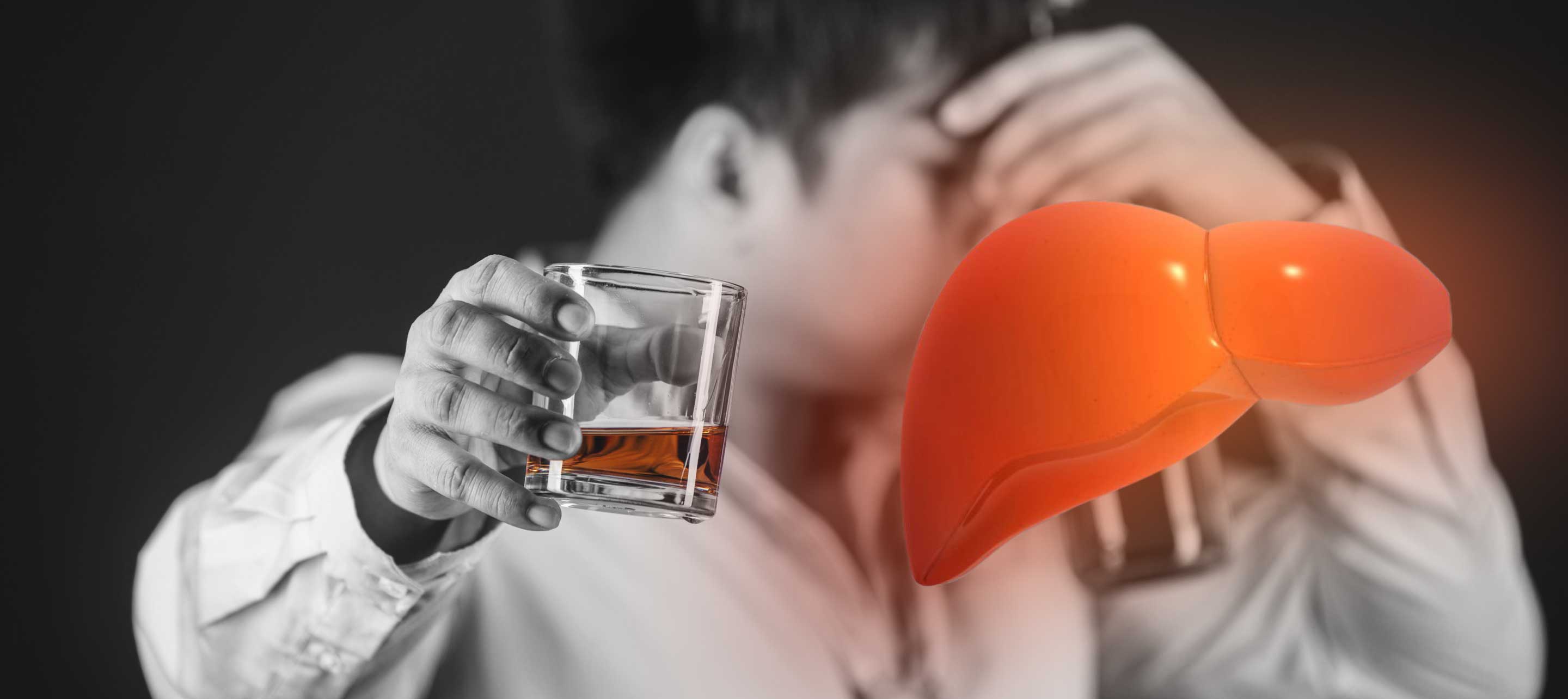 Alcoholic Hepatitis