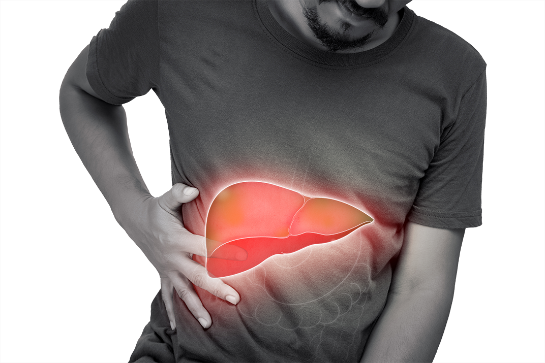 Types of Fatty Liver Disease