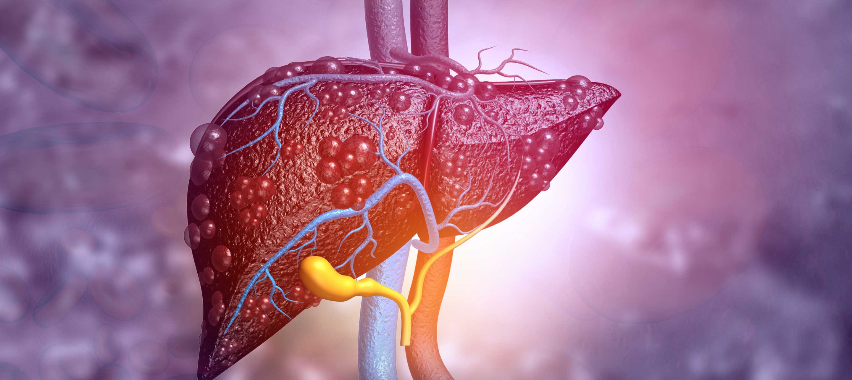 Fatty Liver Disease Treatment & Cost in Lucknow, India