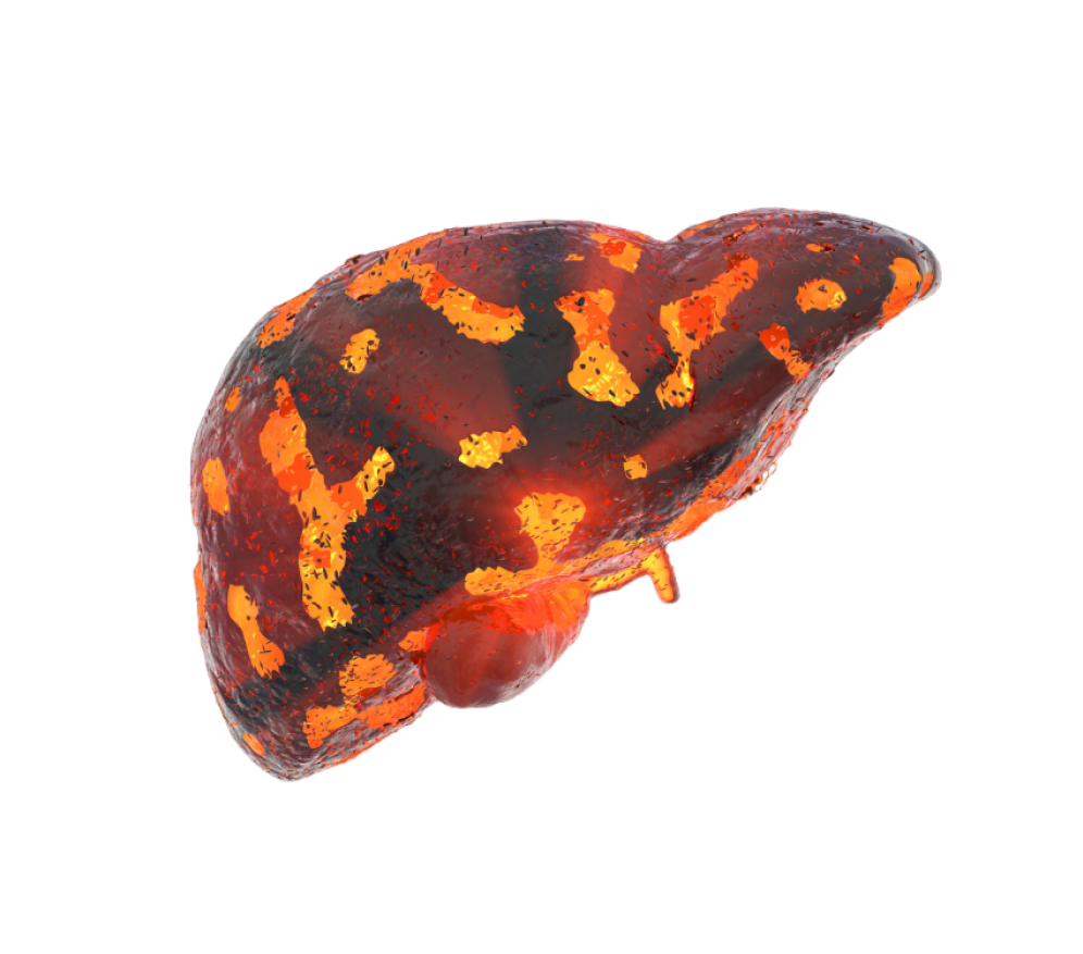 Liver Transplant Process in India