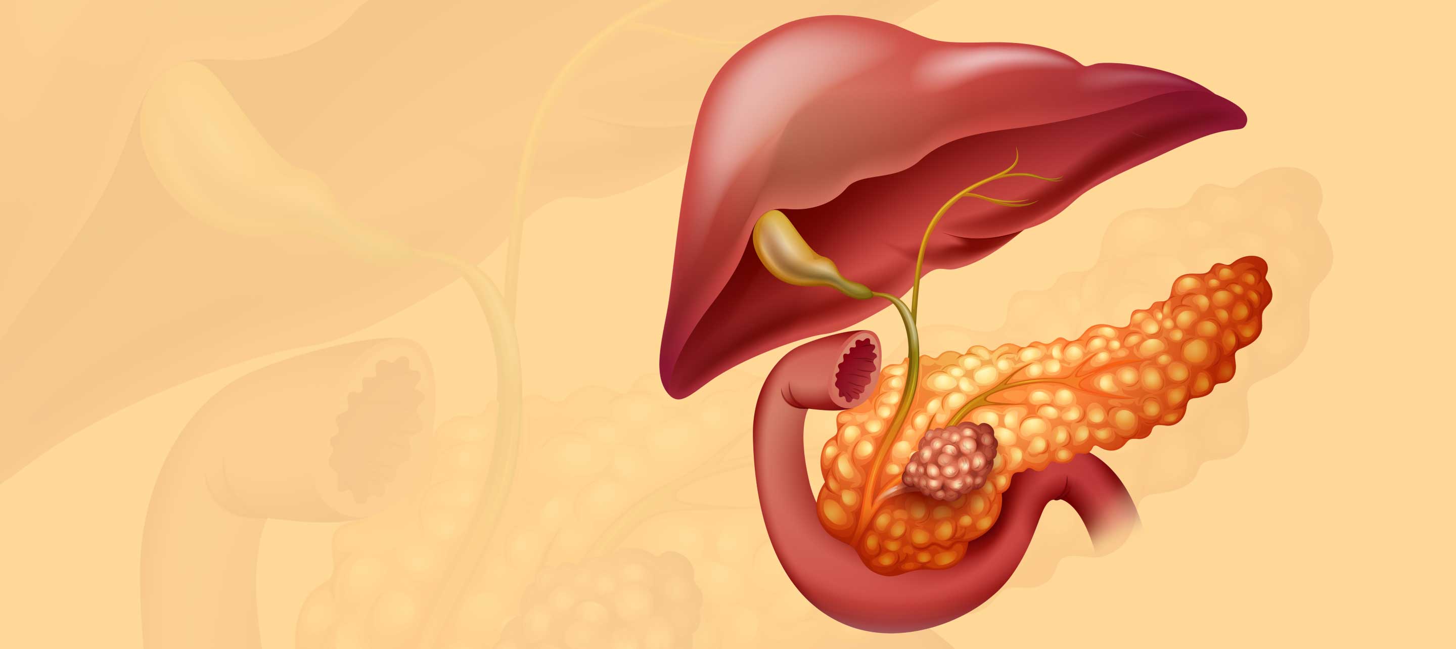 Bile Duct Cancer Surgery Cost in Lucknow, India