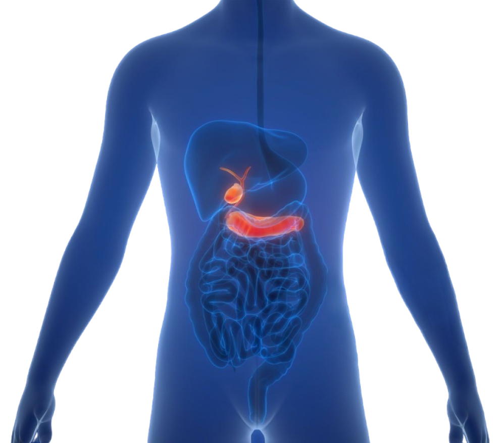 Whipple surgery overview
