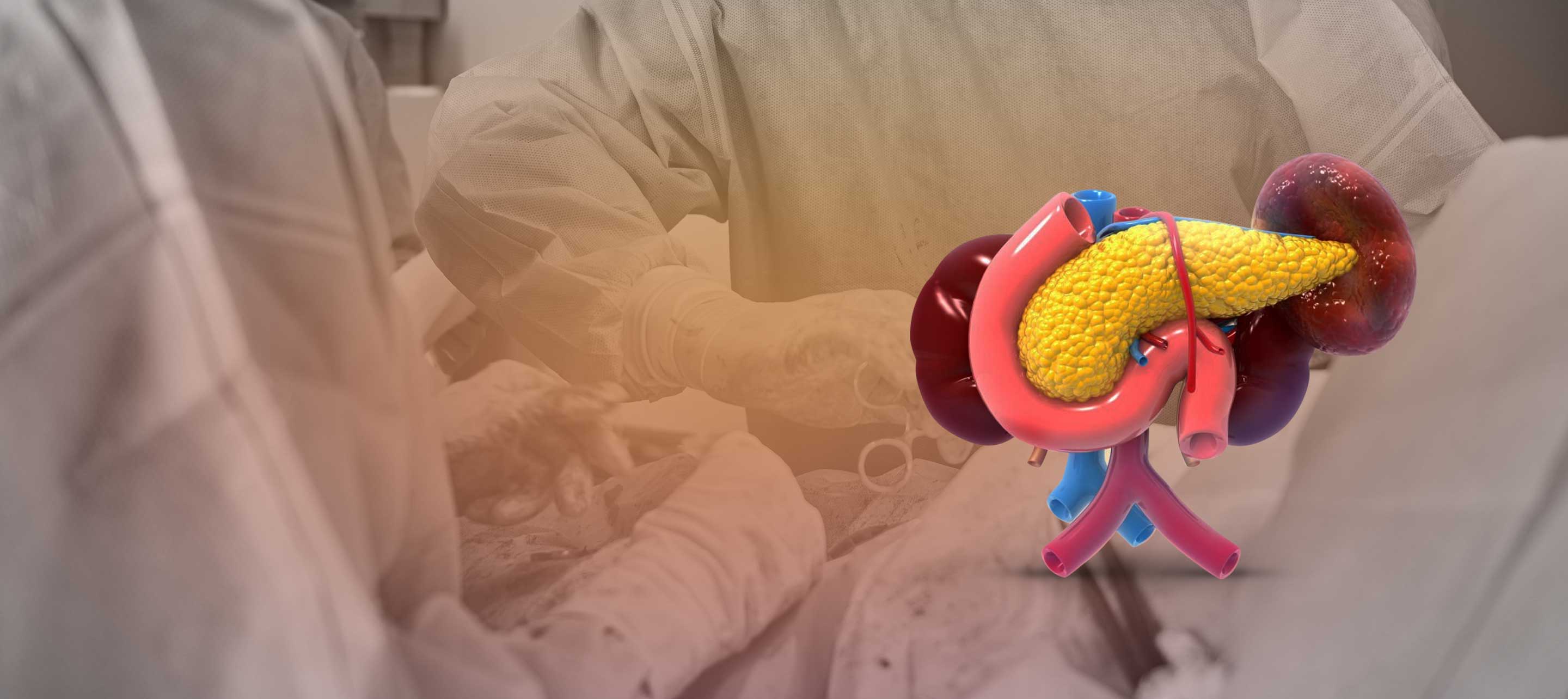 Pancreatic Surgery Cost in Lucknow, India