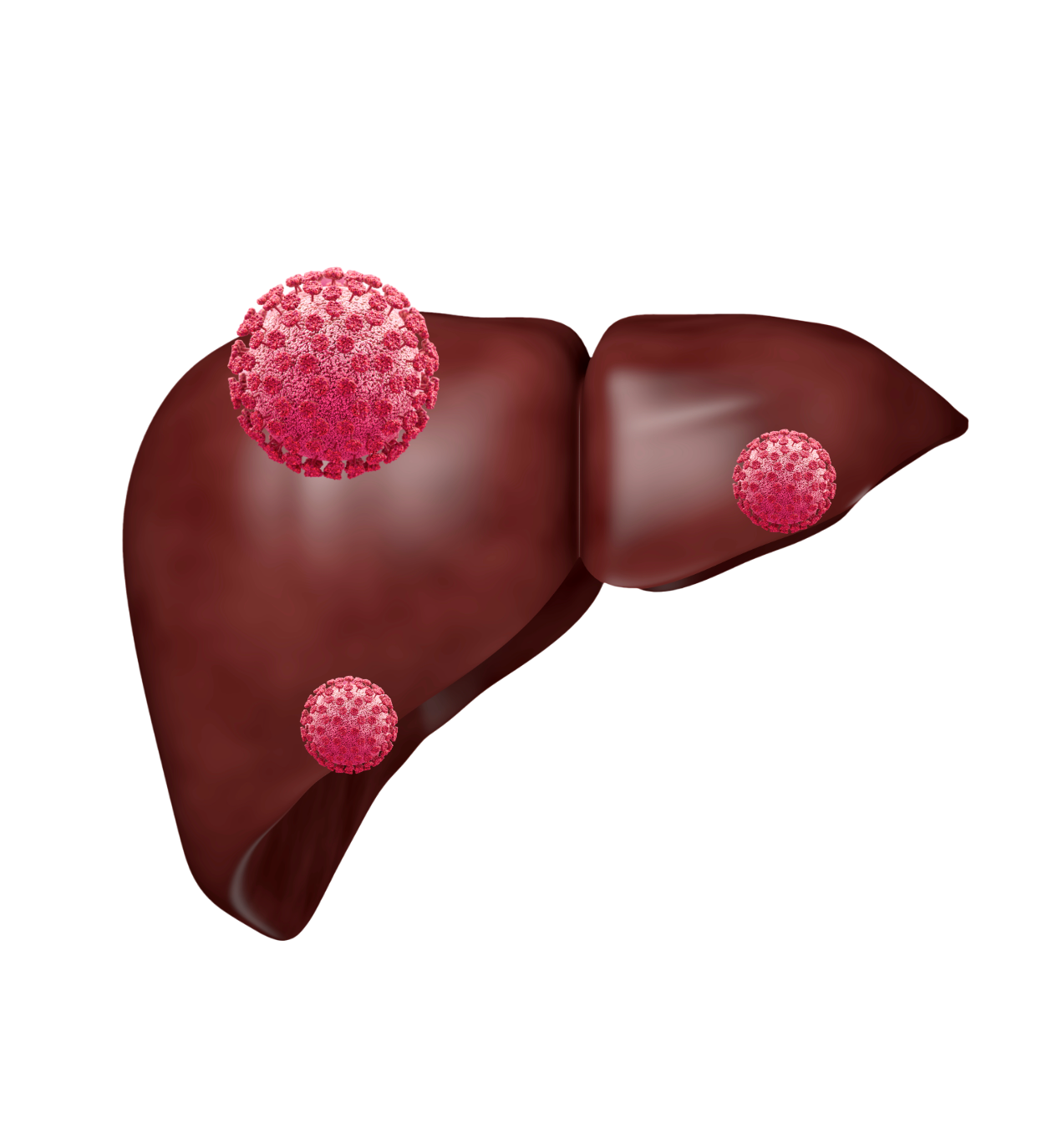 What Is The Purpose Of A Liver Resection