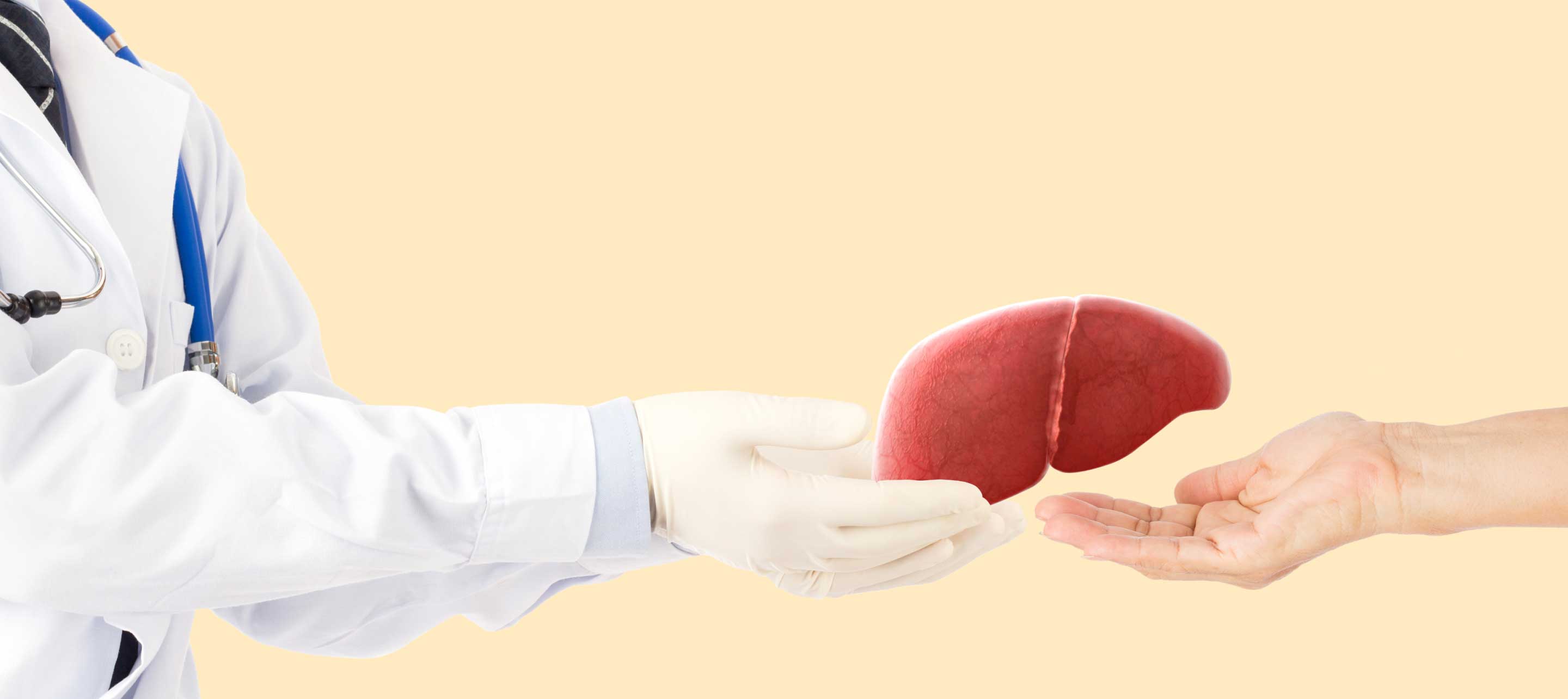 Liver Transplant Evaluation in Lucknow